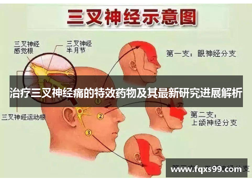 治疗三叉神经痛的特效药物及其最新研究进展解析